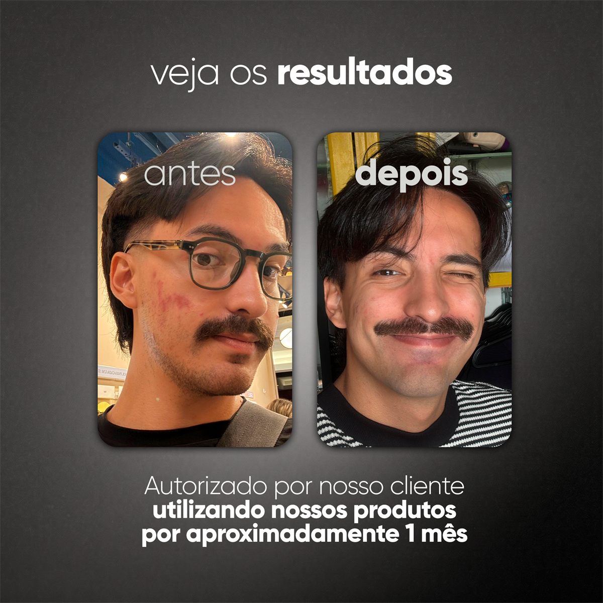 SÉRUM UNIFORMIZADOR - 10% de Niacinamida - 30ml — foto 6